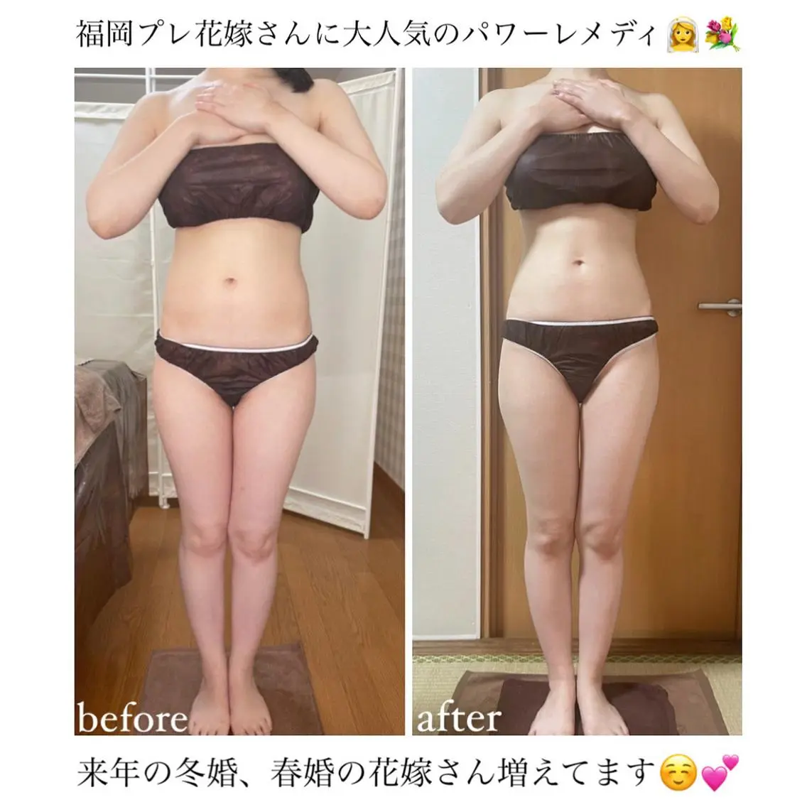 《本気痩せ×疲労改善 》 BILOOPのエステ・リラクイメージ