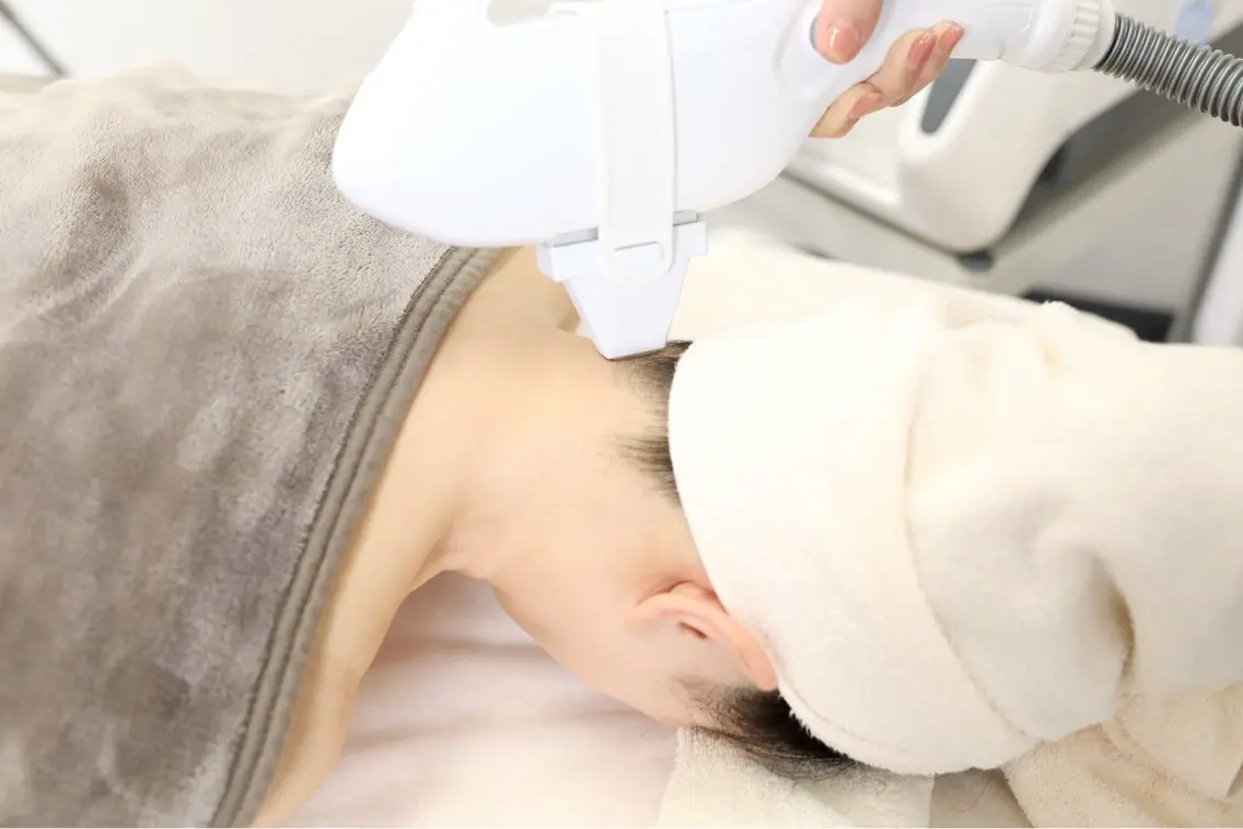 うなじW脱毛の写真