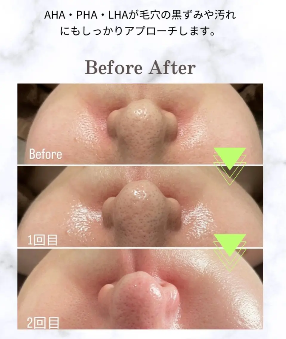 メンズ エステ リラク beauty salonnのエステ・リラクイメージ