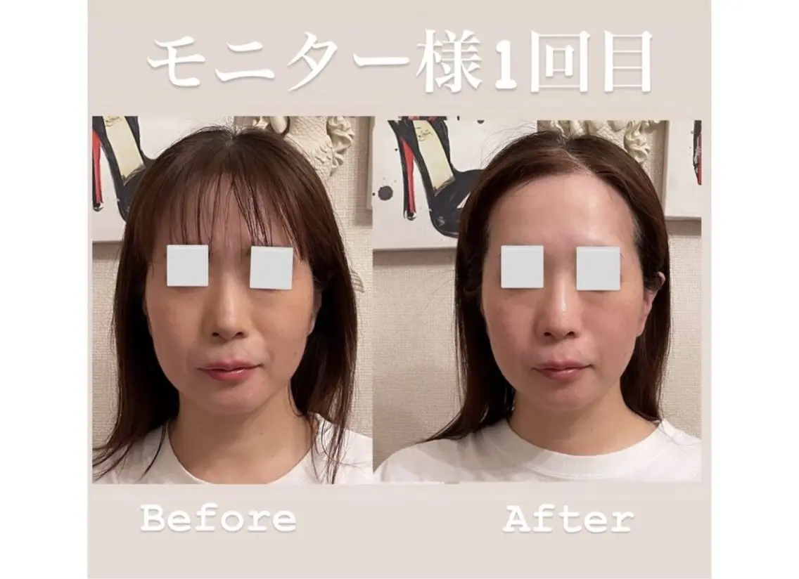 Laule'a 広尾のエステ・リラクイメージ