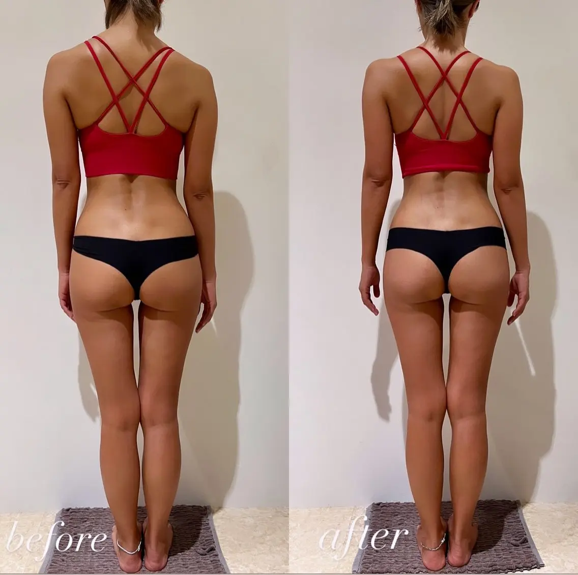 【足痩せ🦵🏻痩身ダイエットメニュー】ラジオ波キャビテーションで浮腫みを除去✨骨盤矯正/ヒップアップしたい方にオススメの写真