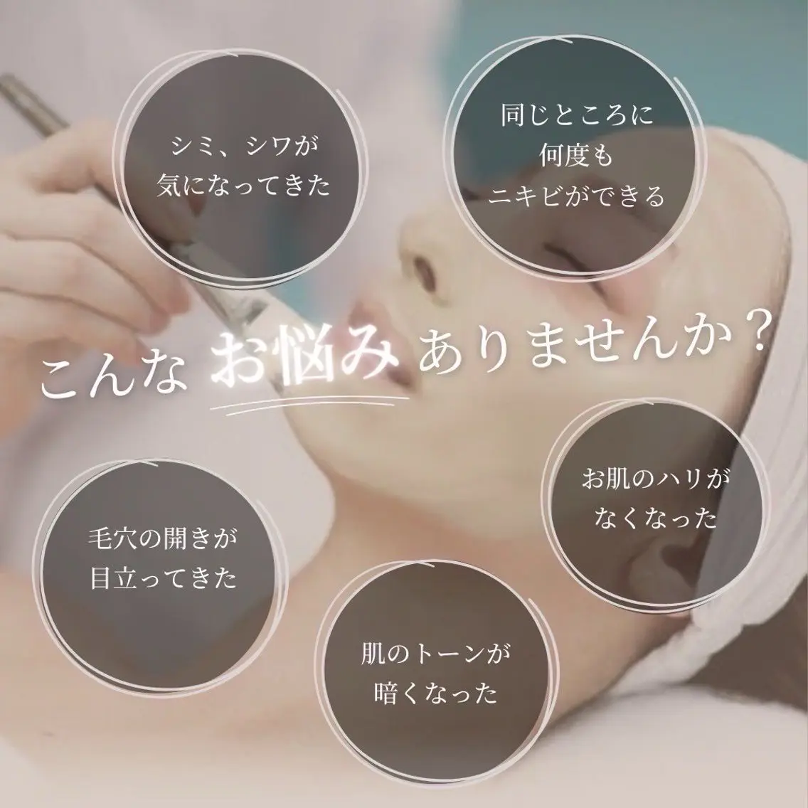 【本格ニキビケア・肌質サポートプログラム】剥けないハーブピーリング！の写真