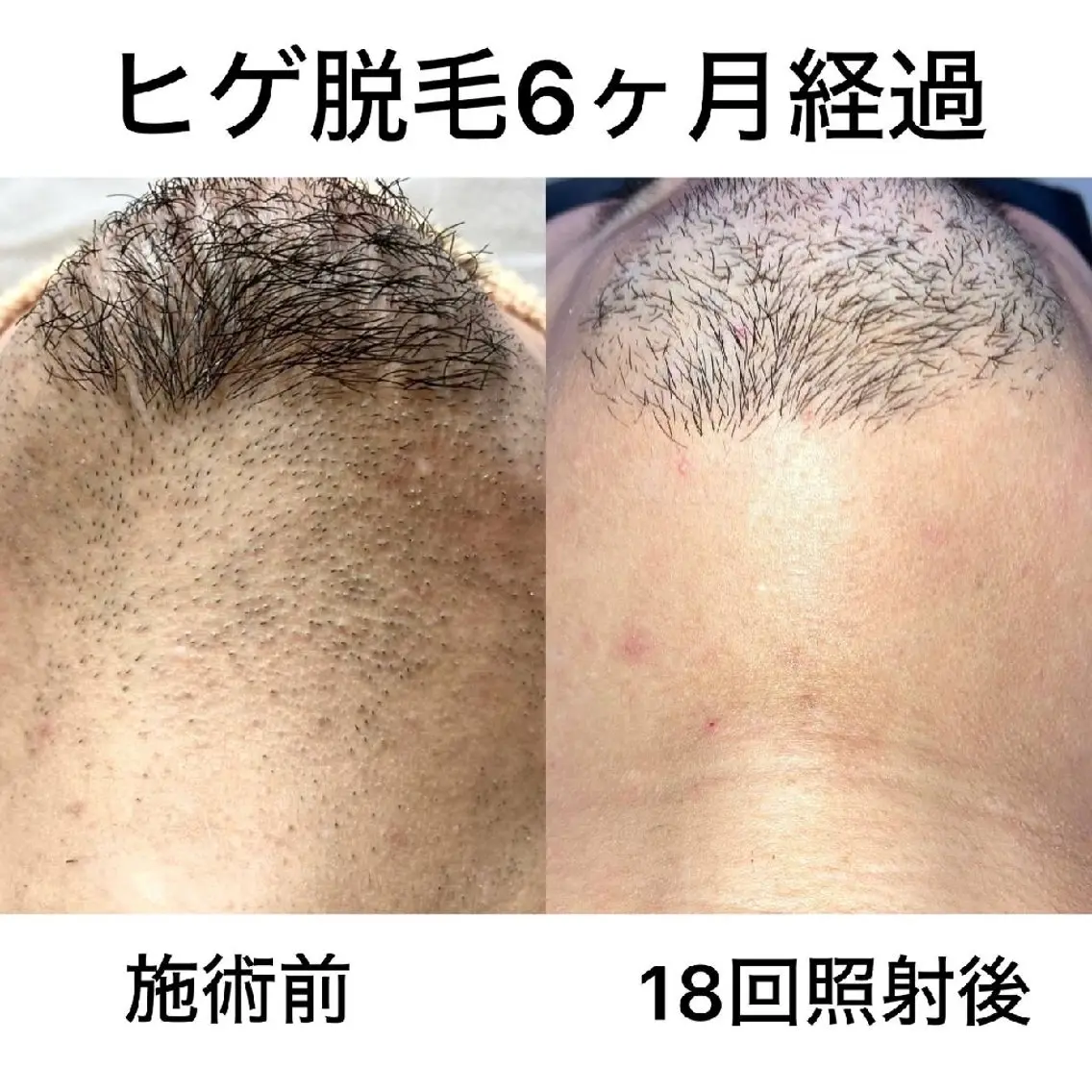 メンズ キッズ 脱毛＊エステ＊リラク 猫の手【丸田和可子】のエステ・リラクイメージ