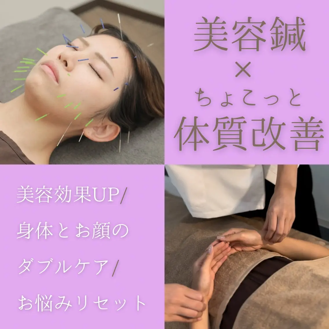 【美容鍼×体質改善鍼】顔も体も内側からキレイに新習慣🌈自律神経/不眠/ニキビ肌/ほうれい線の写真