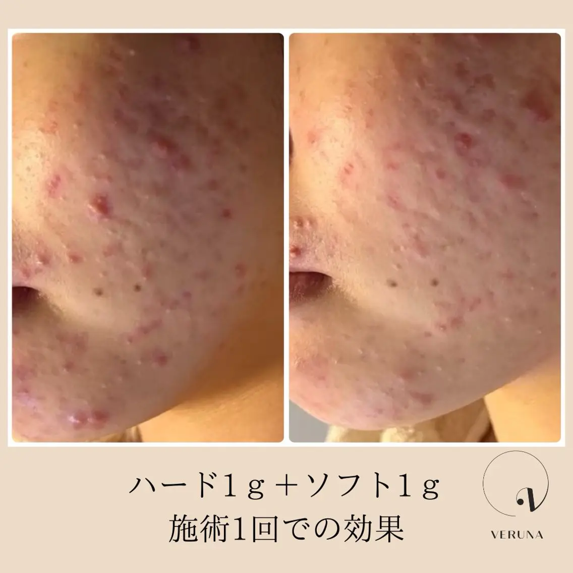 エステ リラク ピーリング専門店 Belluteのエステ・リラクイメージ