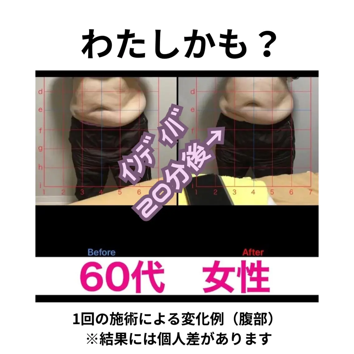 【女性限定】180分|ダイエット体験(モニター検討の方向け)の写真