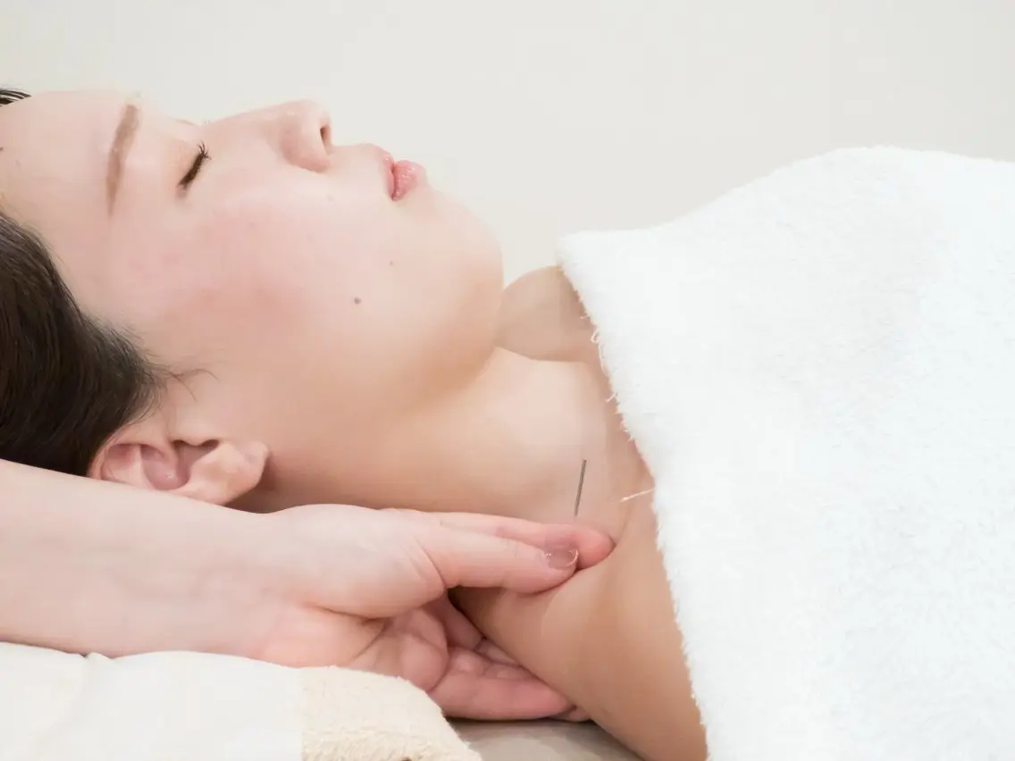 【美容鍼×肩こりケア】お顔も肩こりもまとめてスッキリ🌿✨お試し電気美容鍼90分 ¥ 13,200→ ¥4,900の写真