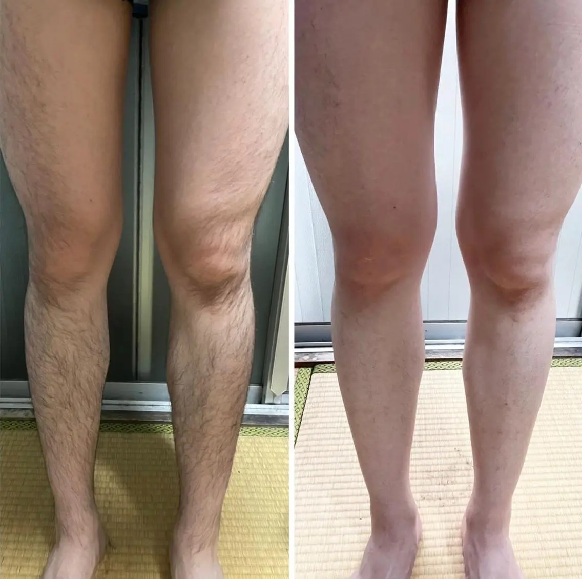 メンズ【脚まるごと】短パンはいてもキレイ！の写真