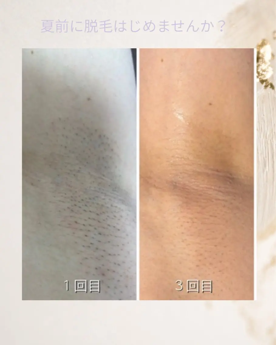 脱毛 女性専用 Lily新原のエステ・リラクイメージ