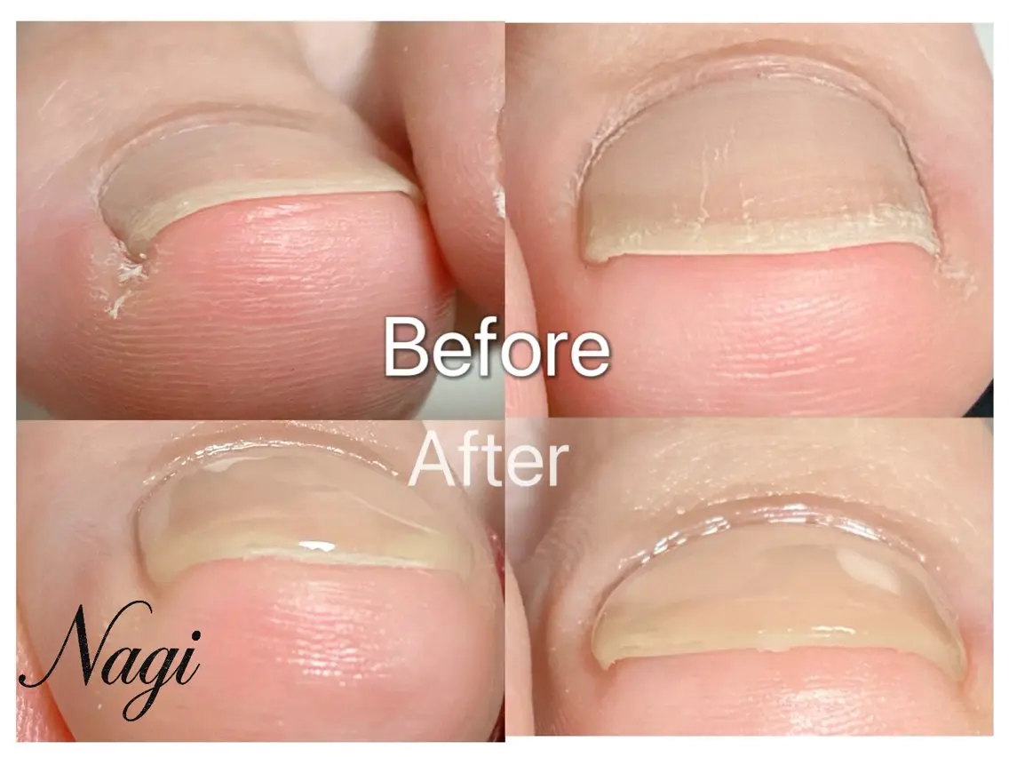 ネイル Nagi Nail 本山のネイルデザイン