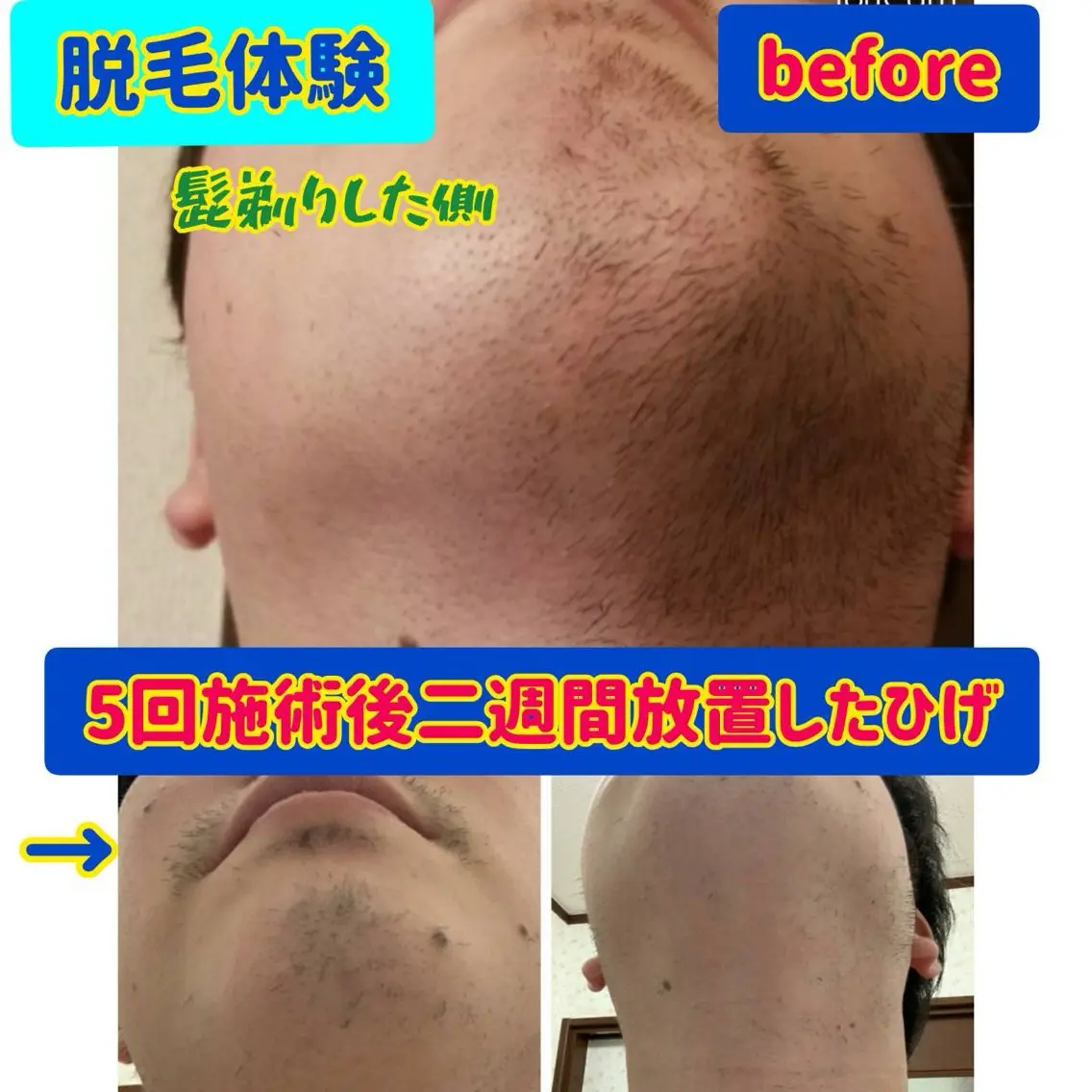脱毛 尾登 俊哉のその他イメージ