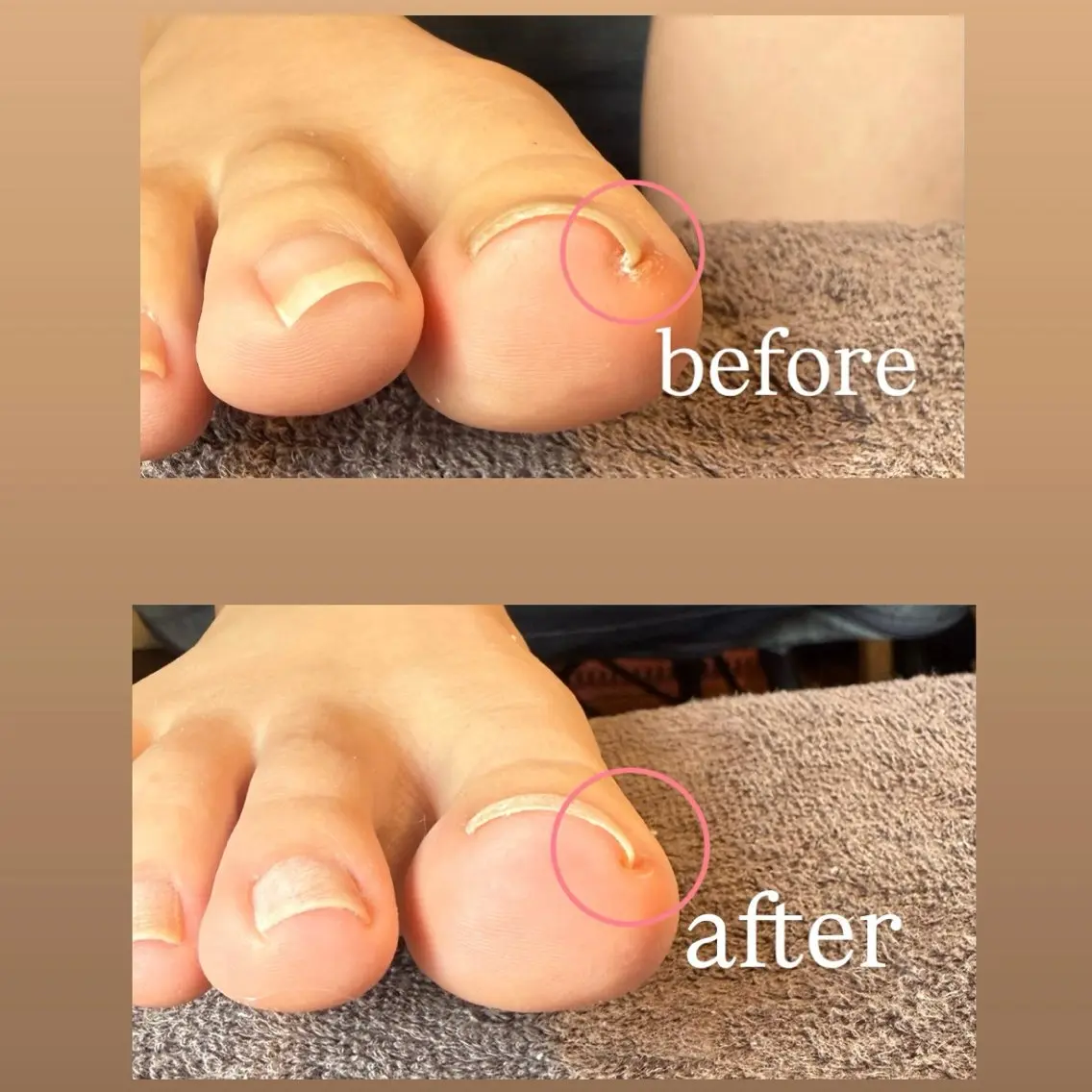 ネイル ジェルネイル フットネイル Welina nailのネイルデザイン
