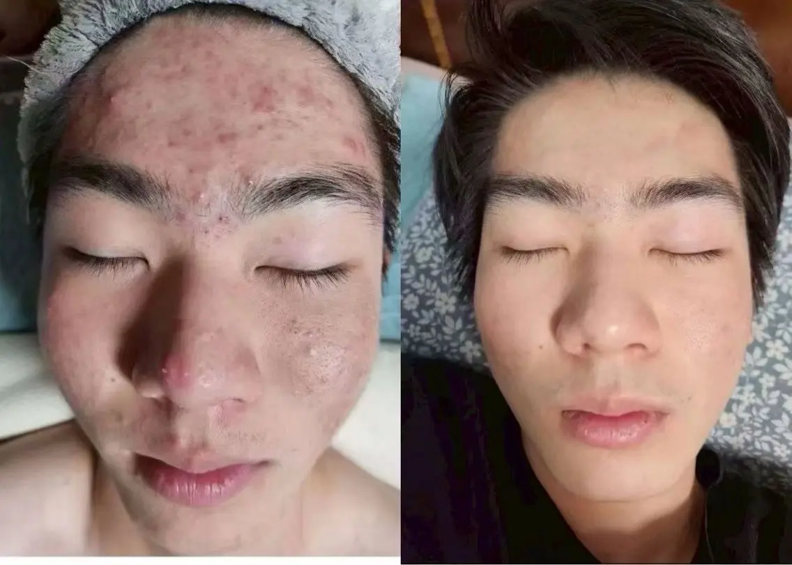 エステ ラムーン アイラッシュ&ヘアメのマツエク・マツパデザイン