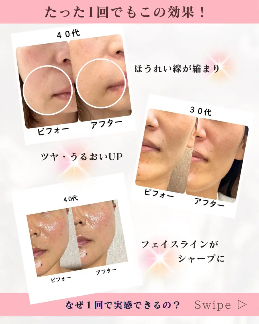 【初回体験価格❤️】うるツヤ小顔フェイシャル(90分)の写真