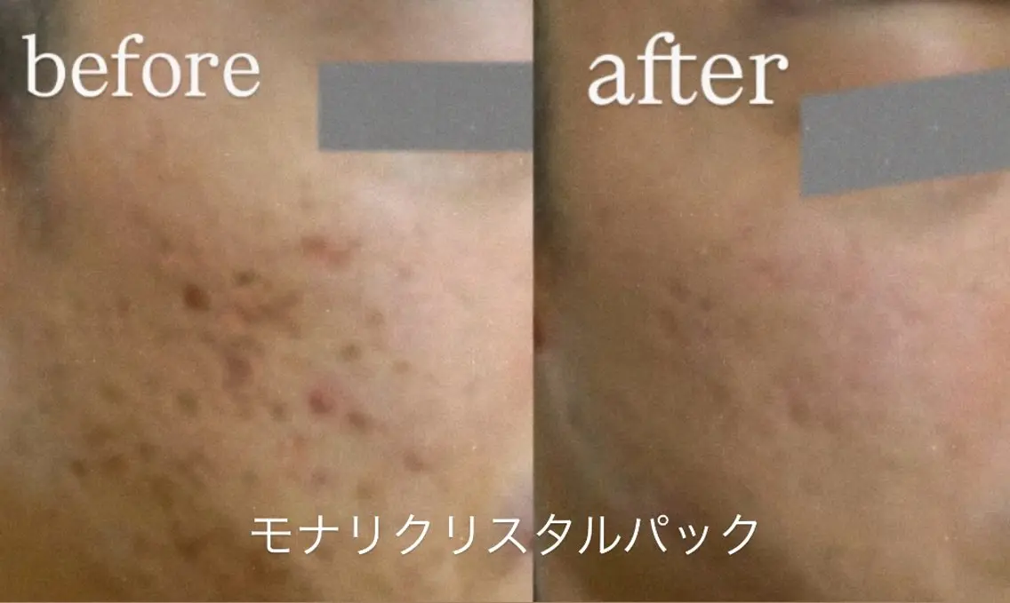 エステ esthesalon O'-en-のエステ・リラクイメージ