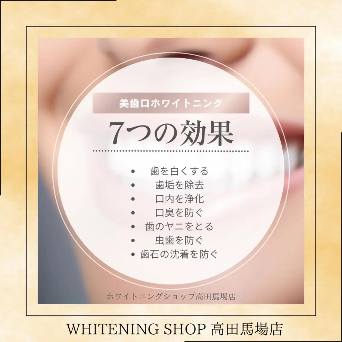 メンズ その他 ホワイトニング ショップ高田馬場店のその他イメージ