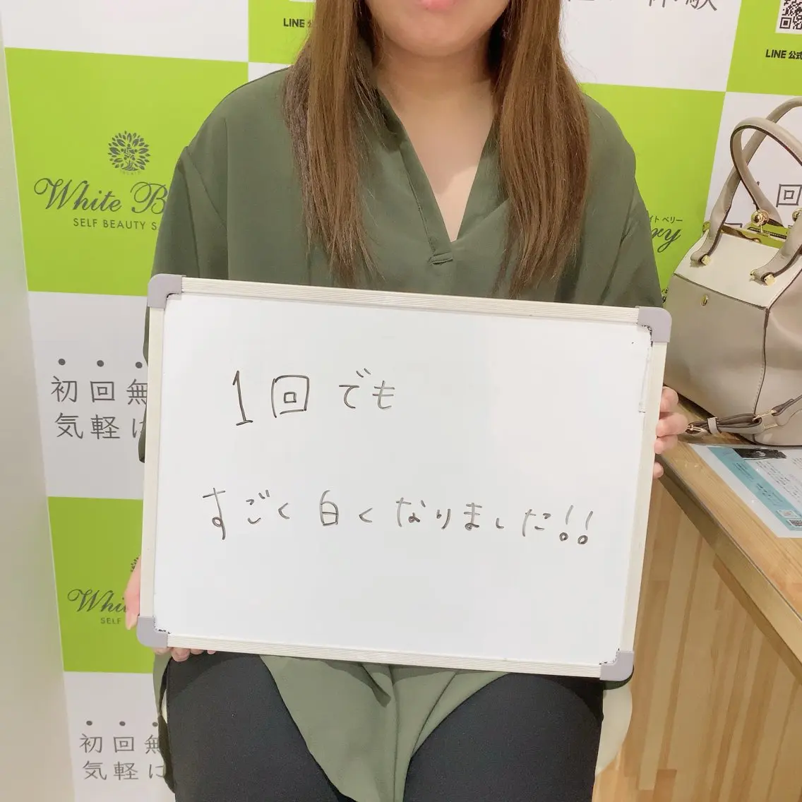 セルフホワイトニング 🦷口元垢抜け✨のその他イメージ