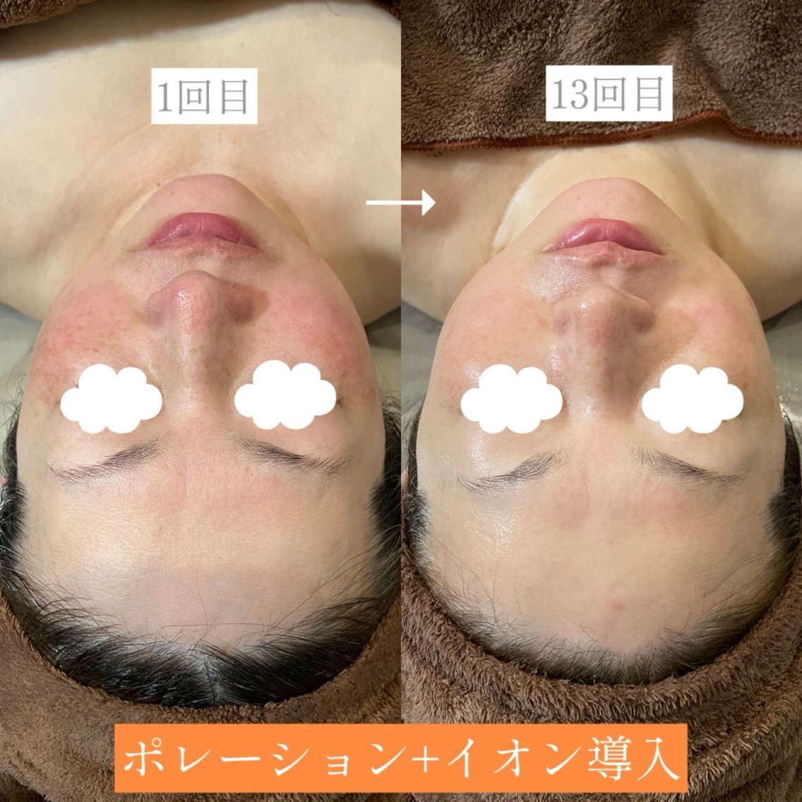 エステ Folche春日 イイダ🪻のエステ・リラクイメージ