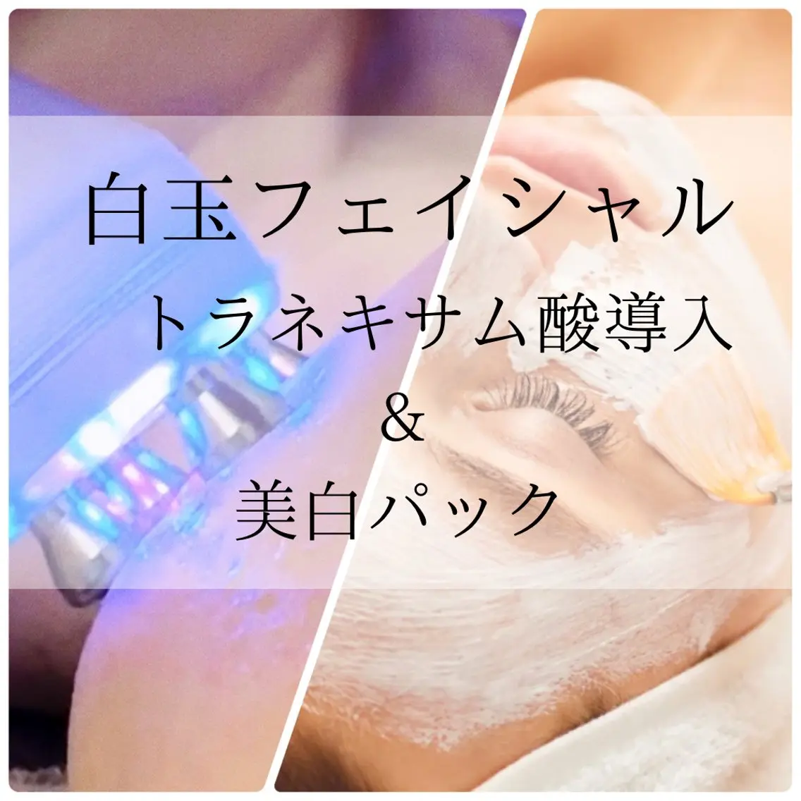 美肌シミケアサロン 4tune.RUMIのその他イメージ