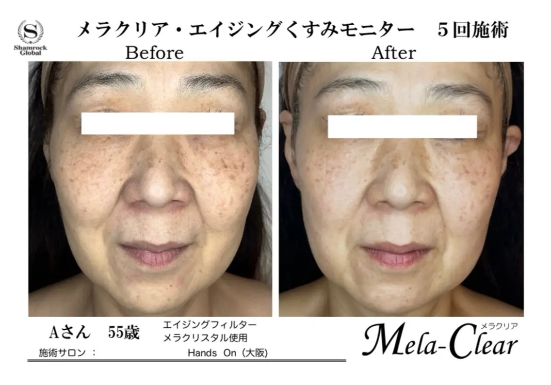 光フォト美容 エイジング、敏感肌のエステ・リラクイメージ
