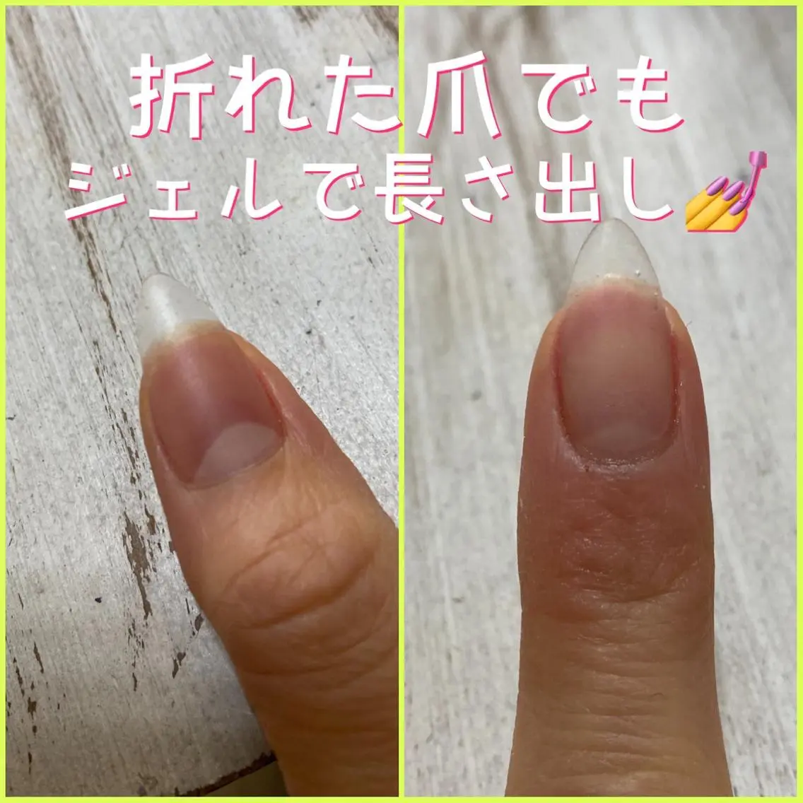 ネイル ♢ME2ROOM♢ #巻き爪#リラクのネイルデザイン
