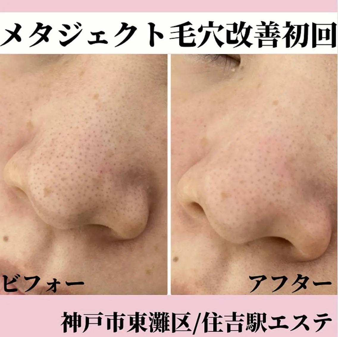 Salonde ELSA／河合のエステ・リラクイメージ