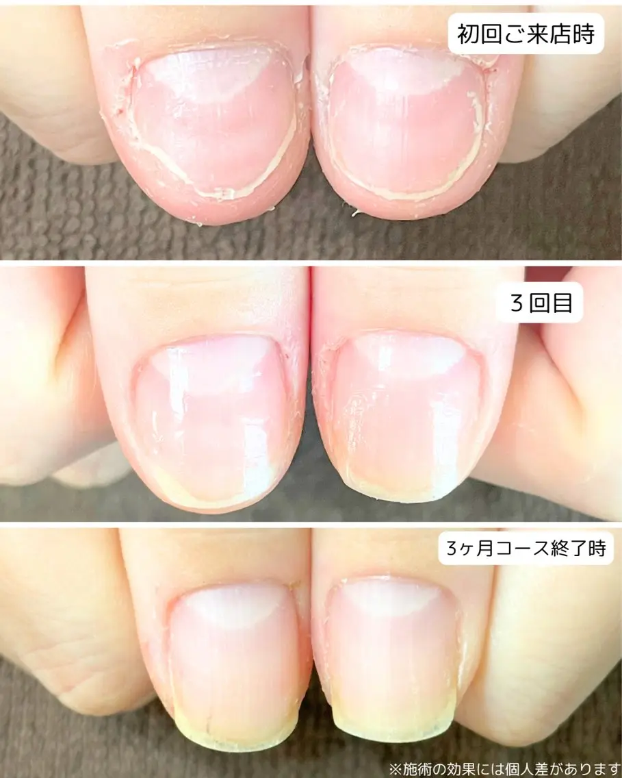 ネイル ハンドネイル ハンドケア 自爪育成専門店 Kapilinaのネイルデザイン