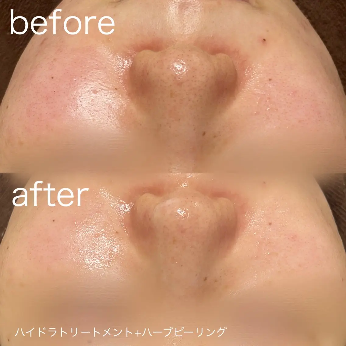 脱毛 lulularico Yuのネイルデザイン