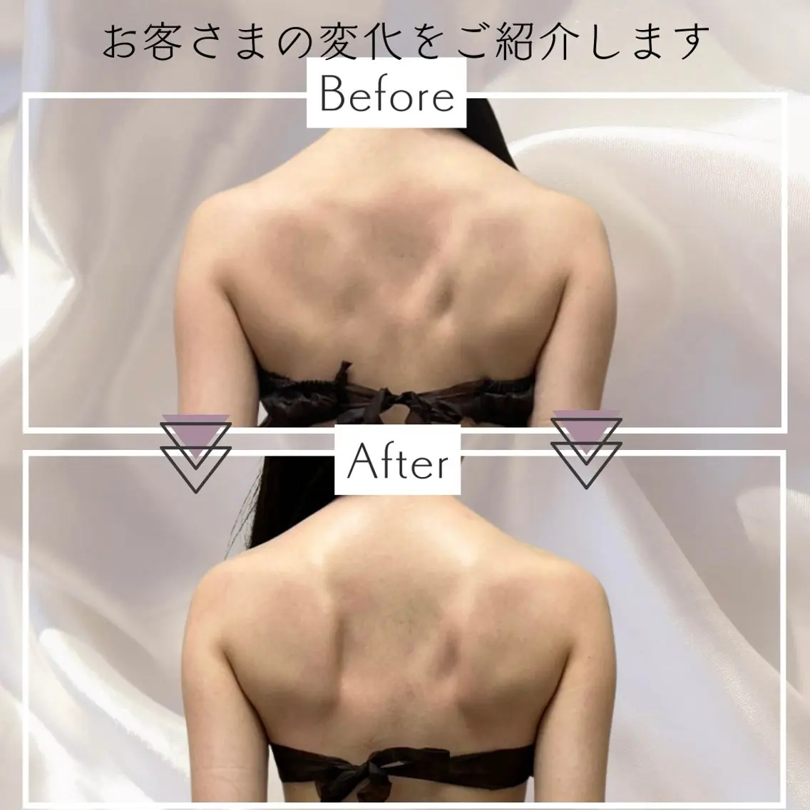 《華奢な背中/ぽっこり腹解消》上半身集中ハイパーナイフ60分の写真