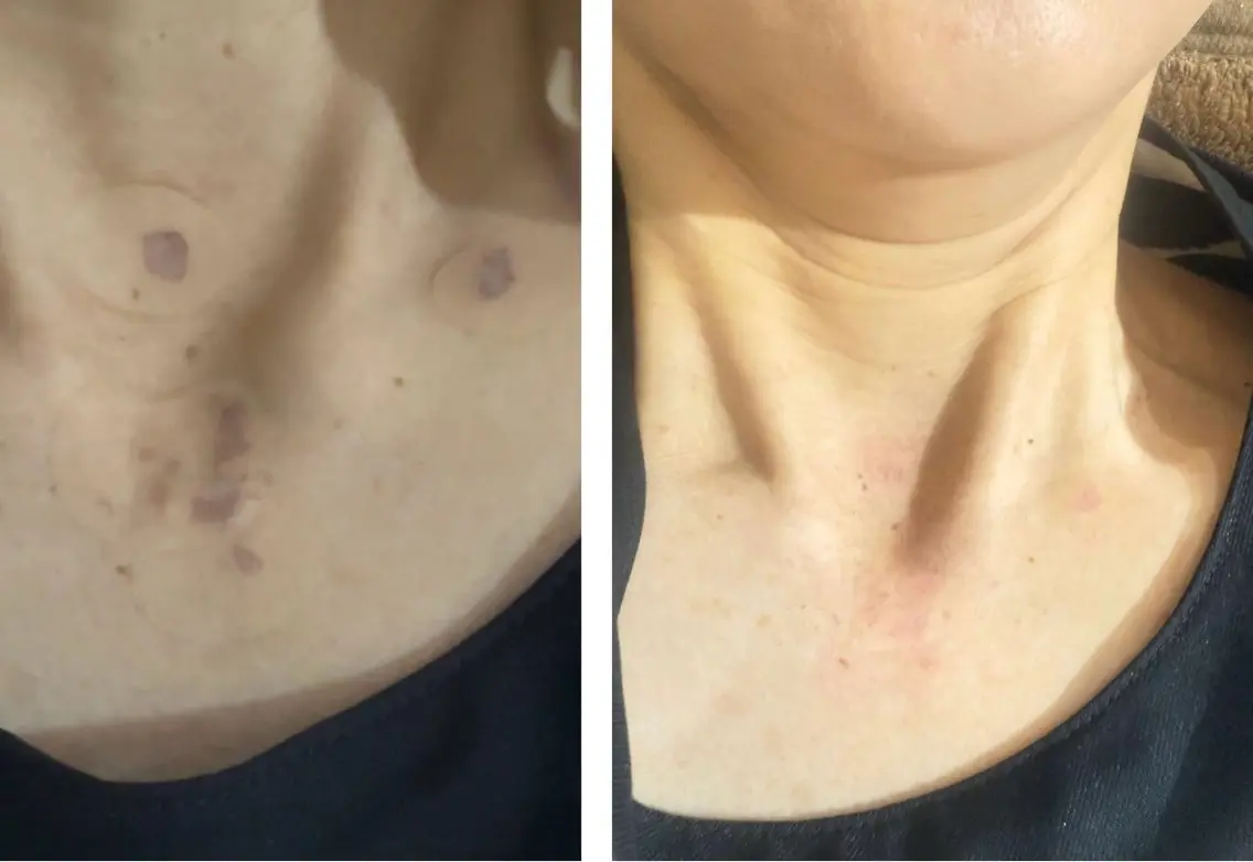 エステ healthy& beautyDEWAのエステ・リラクイメージ
