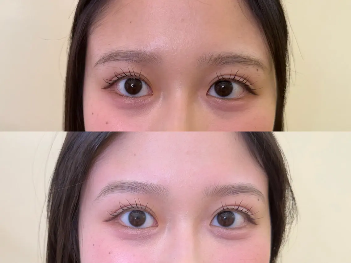 アイブロウ ワックス脱毛 眉カット その他(アイブロウ) 眉毛/美肌の専門店 Mily🍒ミウィの眉毛・アイブロウイメージ