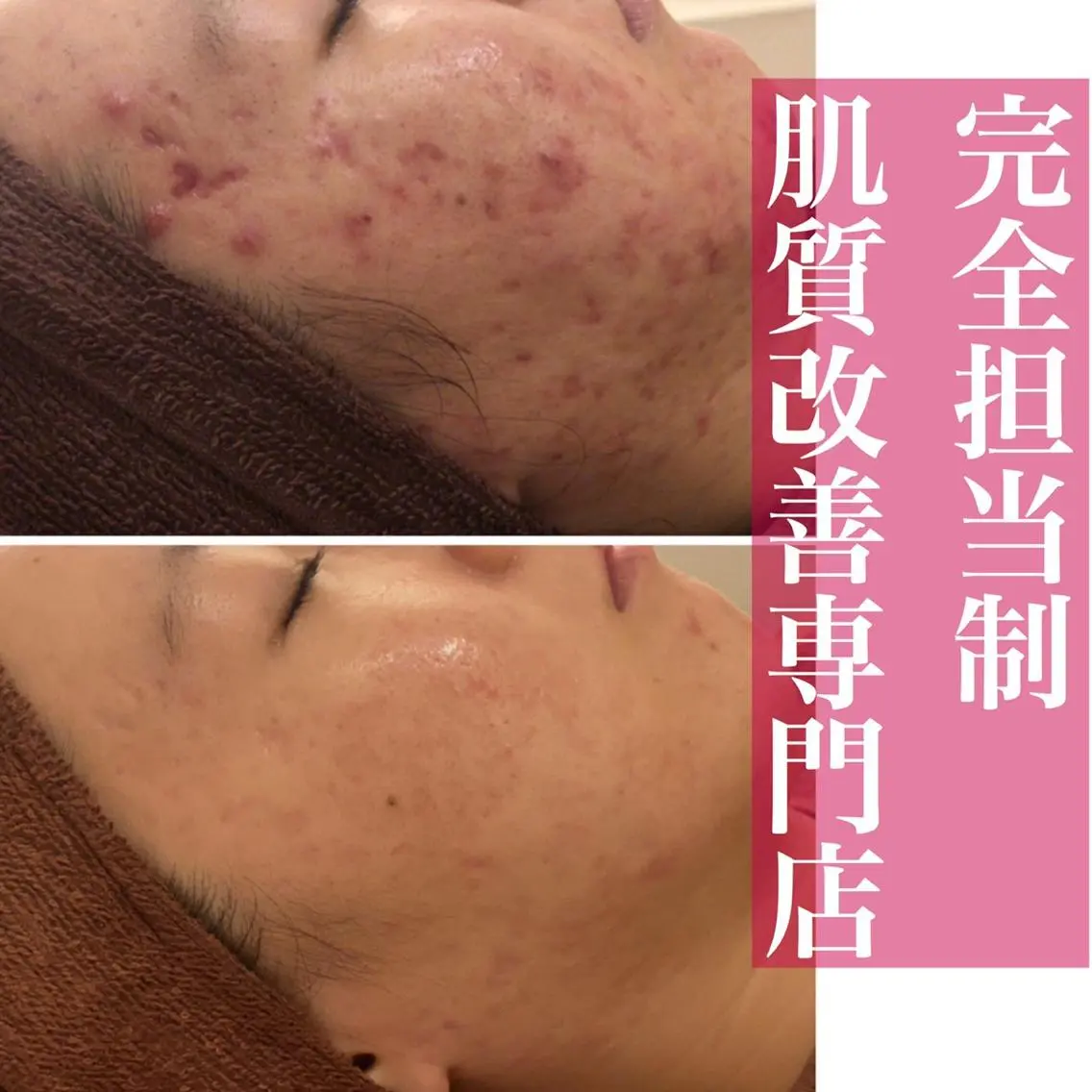 ミディアム カラー パーマ ヘアアレンジ メンズ キッズ ネイル マツエク・マツパ エステ リラク ニキビ・肌質改善専門 ♡人生が変わるサロンのエステ・リラクイメージ