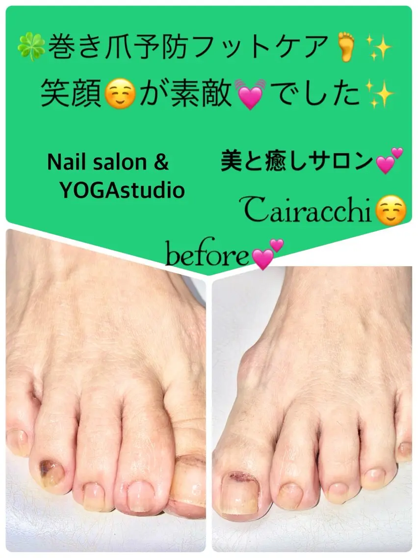 ネイル フットネイル フットネイル Tairacchi タイラッチのエステ・リラクイメージ