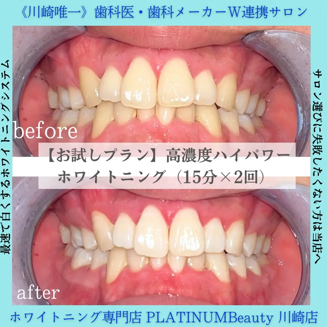PLATINUM Beauty 川崎店のエステ・リラクイメージ