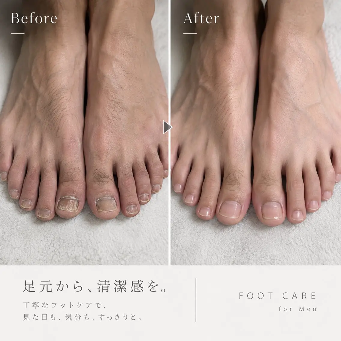 ✨📃フットケア(フットバス、角質ケア、形整え、甘皮ケア、爪表面ケア、保湿) 直前割はフットバス、角質ケアなし✨の写真