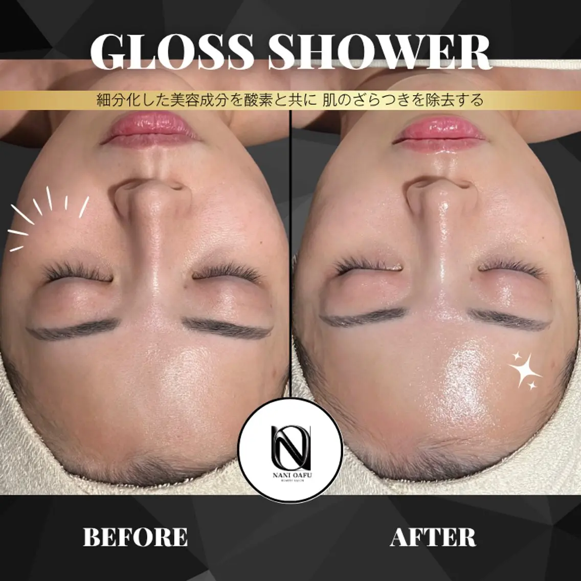 【🫧韓国式艶肌×透明感ケア】GLOSS SHOWER｜敏感肌・ダウンタイム肌にもおすすめ〈本町限定〉の写真