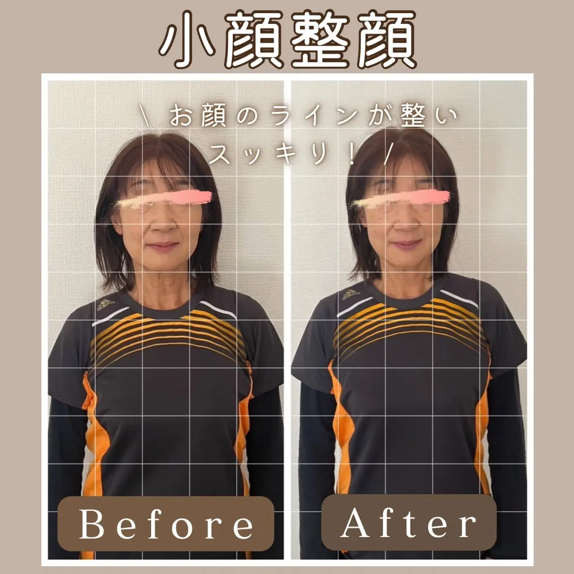 小顔整顔の写真