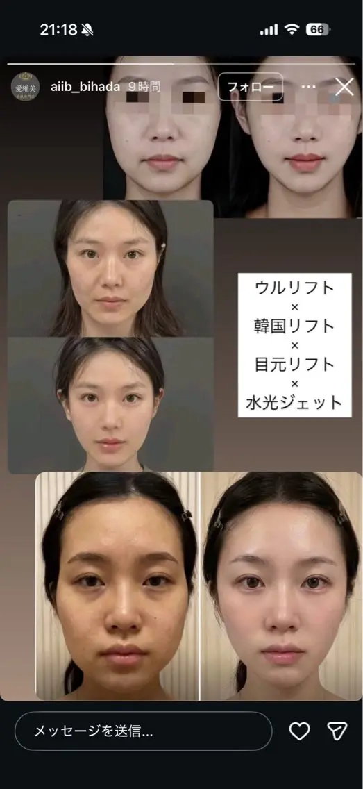 マツエク・マツパ エステ リラク 愛維美水光美肌専門店 メンズレディースokのエステ・リラクイメージ