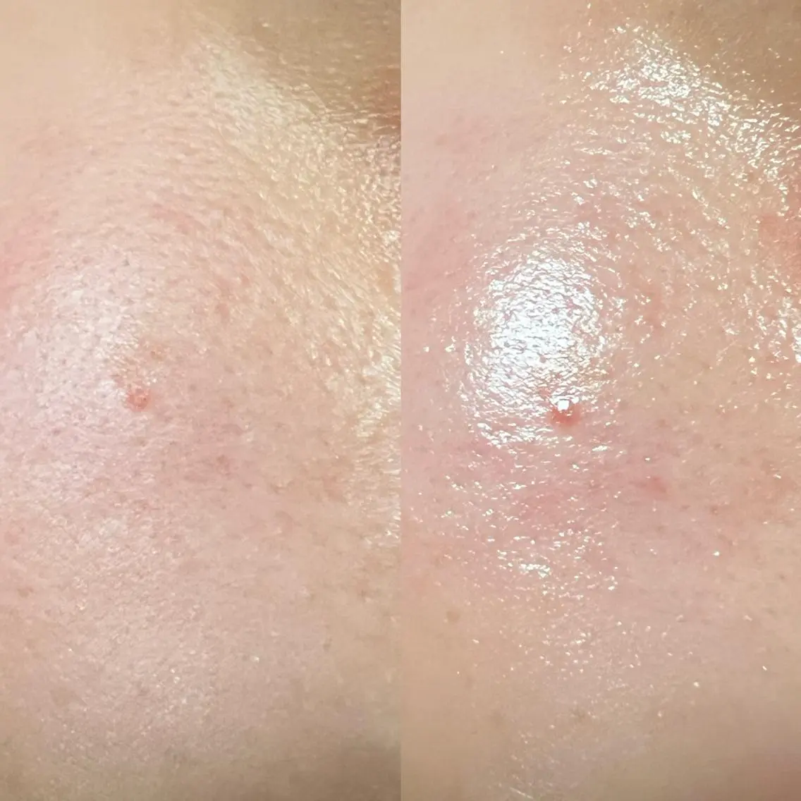 エステ リラク lymph care 'Welnəsのエステ・リラクイメージ