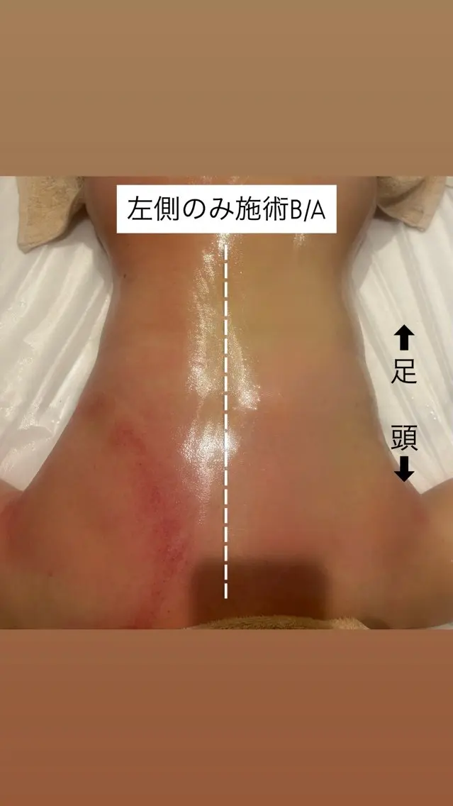 Hariccuma 荒井のエステ・リラクイメージ