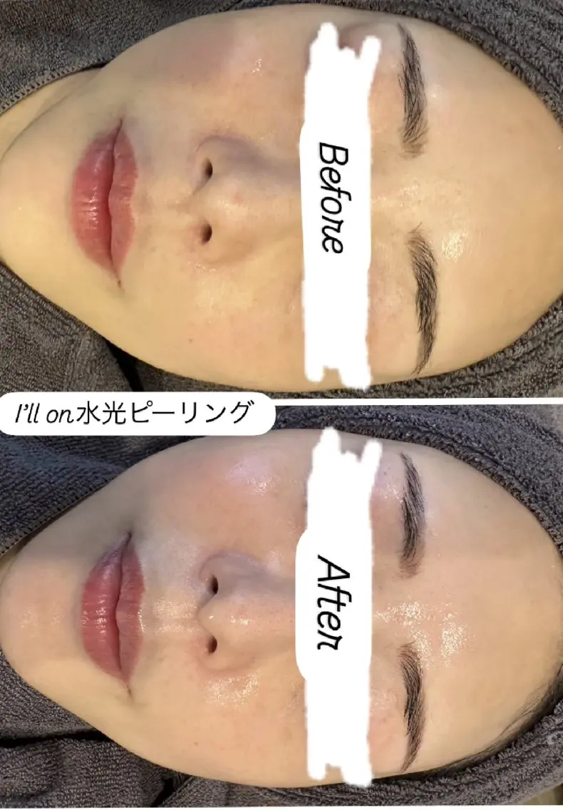 エステ 看護師 桐山 まどかのエステ・リラクイメージ