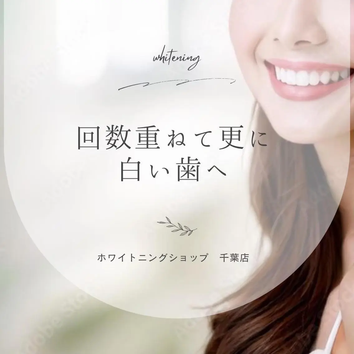 メンズ エステ ホワイトニング ショップ千葉店のその他イメージ