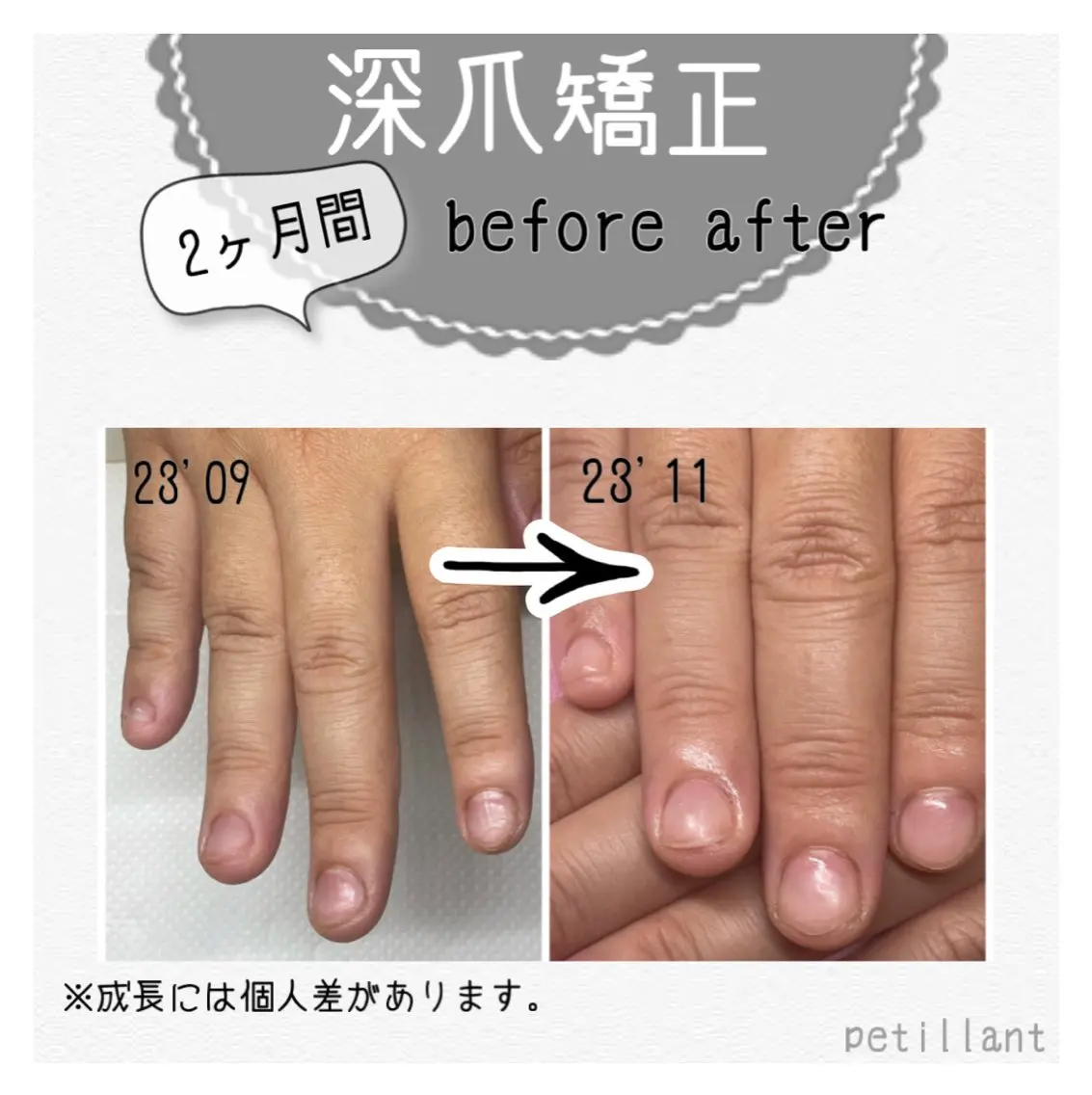 ネイル クリアネイル 長さ出し ジェルネイル マットネイル ピンク nail salon petillantのネイルデザイン