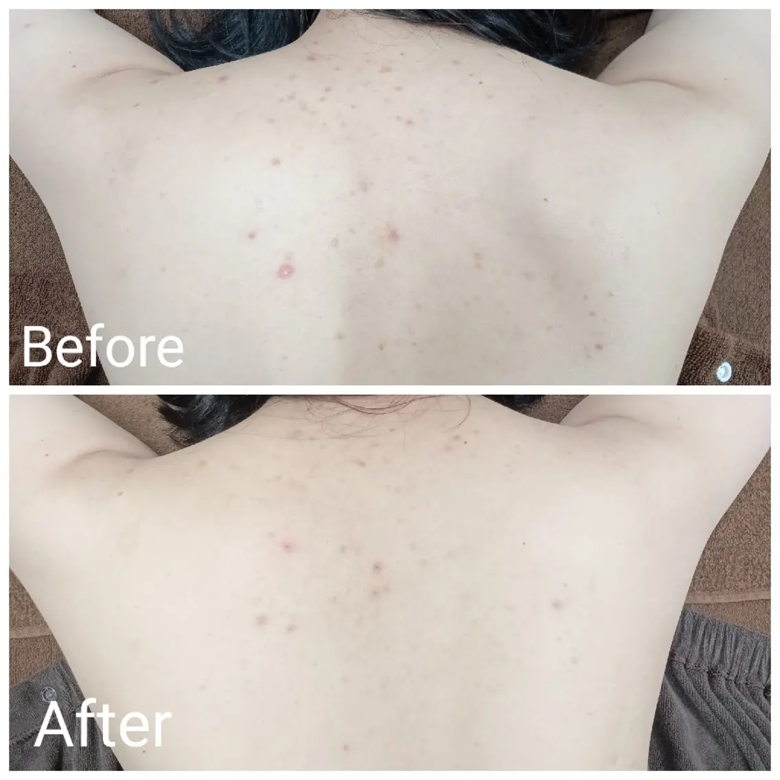 エステ リラク 肌質改善Beauty salon Renのエステ・リラクイメージ