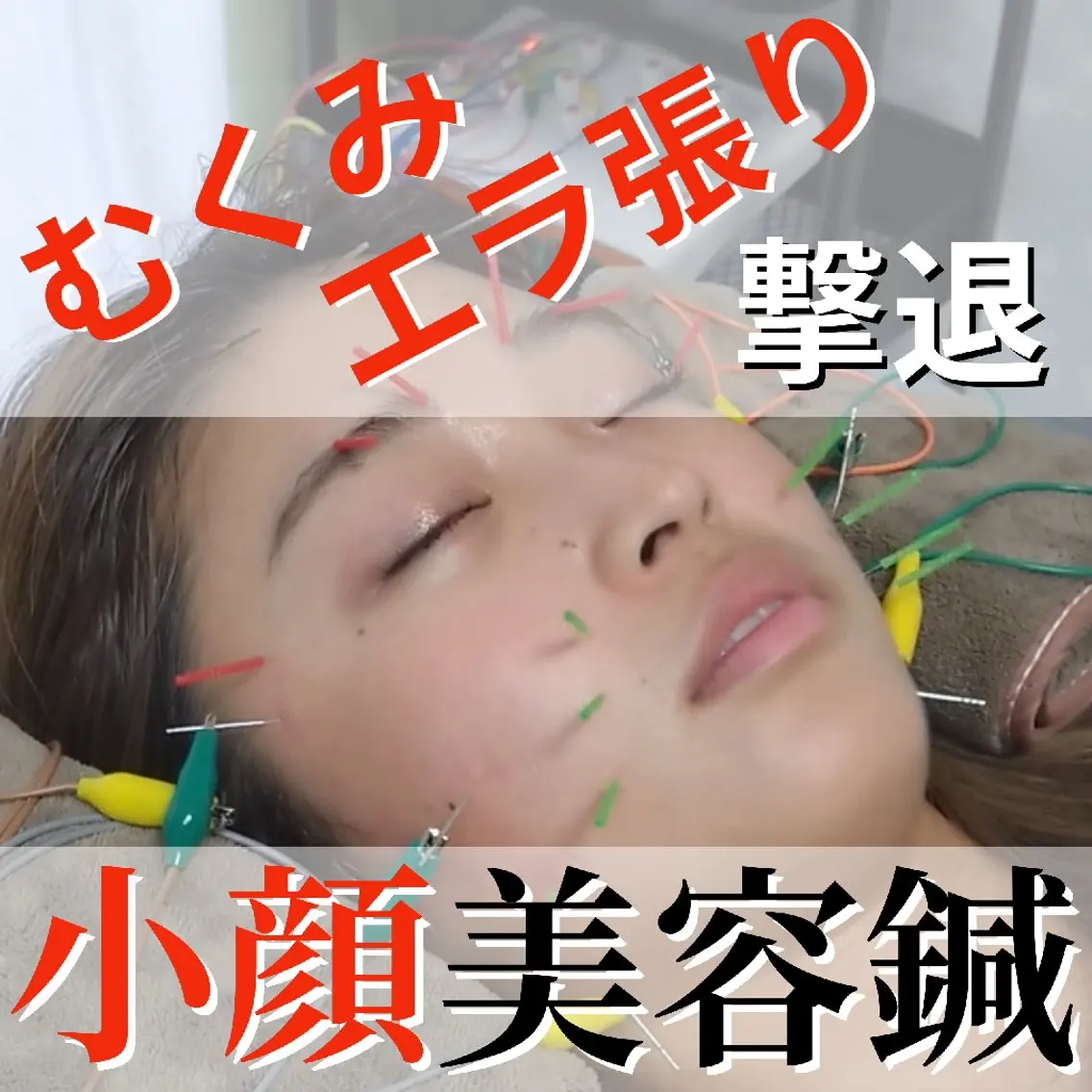 小顔と姿勢改善のプロ ｜整体と美容鍼のぐちのエステ・リラクイメージ
