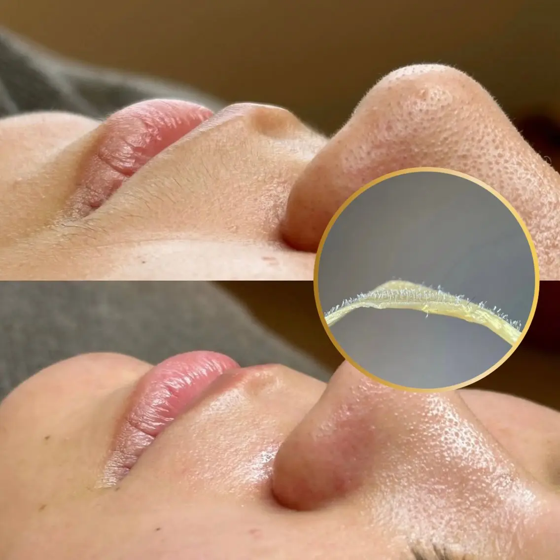 【産毛•角栓スッキリ】美肌フェイスwax艶肌パック付の写真
