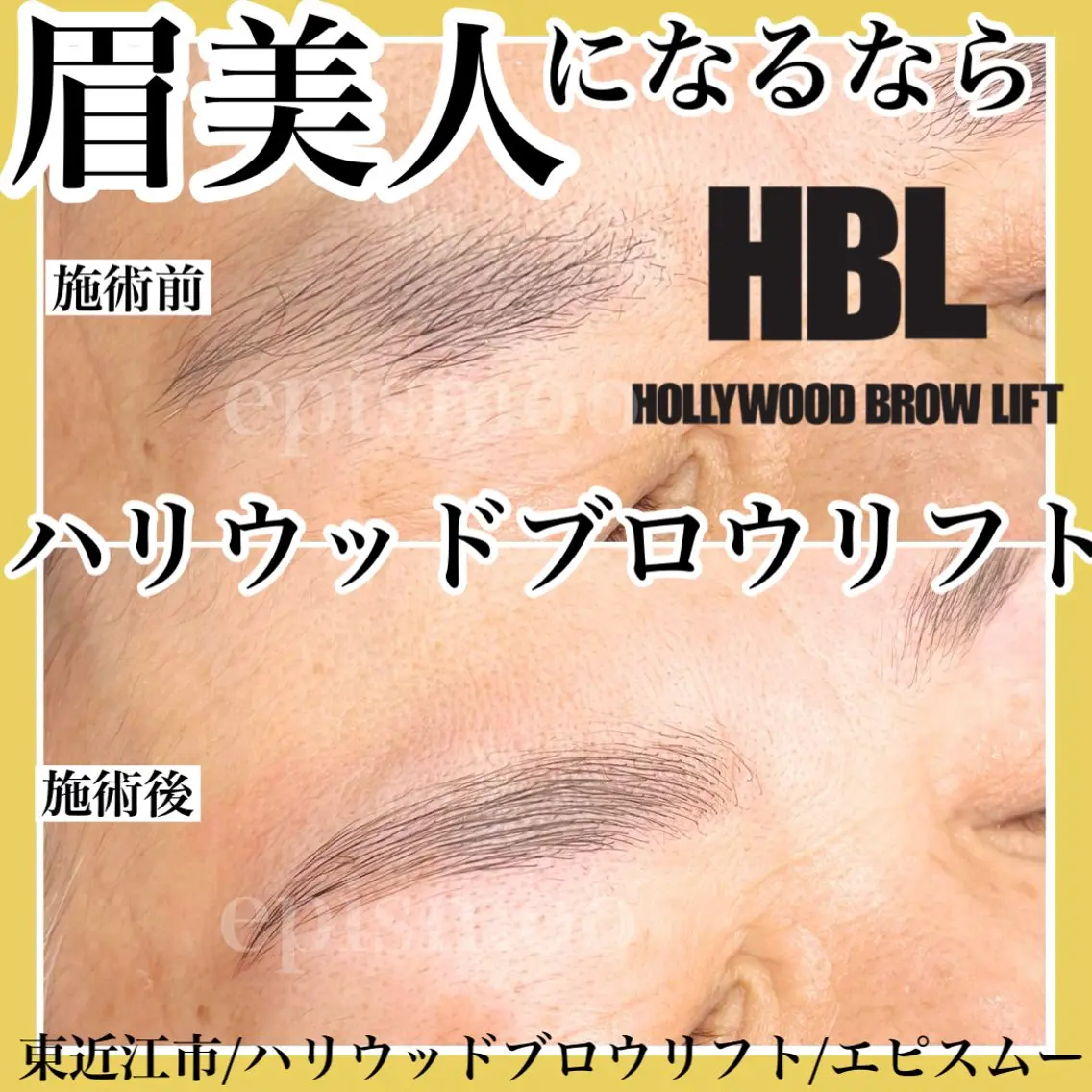 アイブロウ その他(アイブロウ) epismoo 脱毛/HBL/毛穴の眉毛・アイブロウイメージ