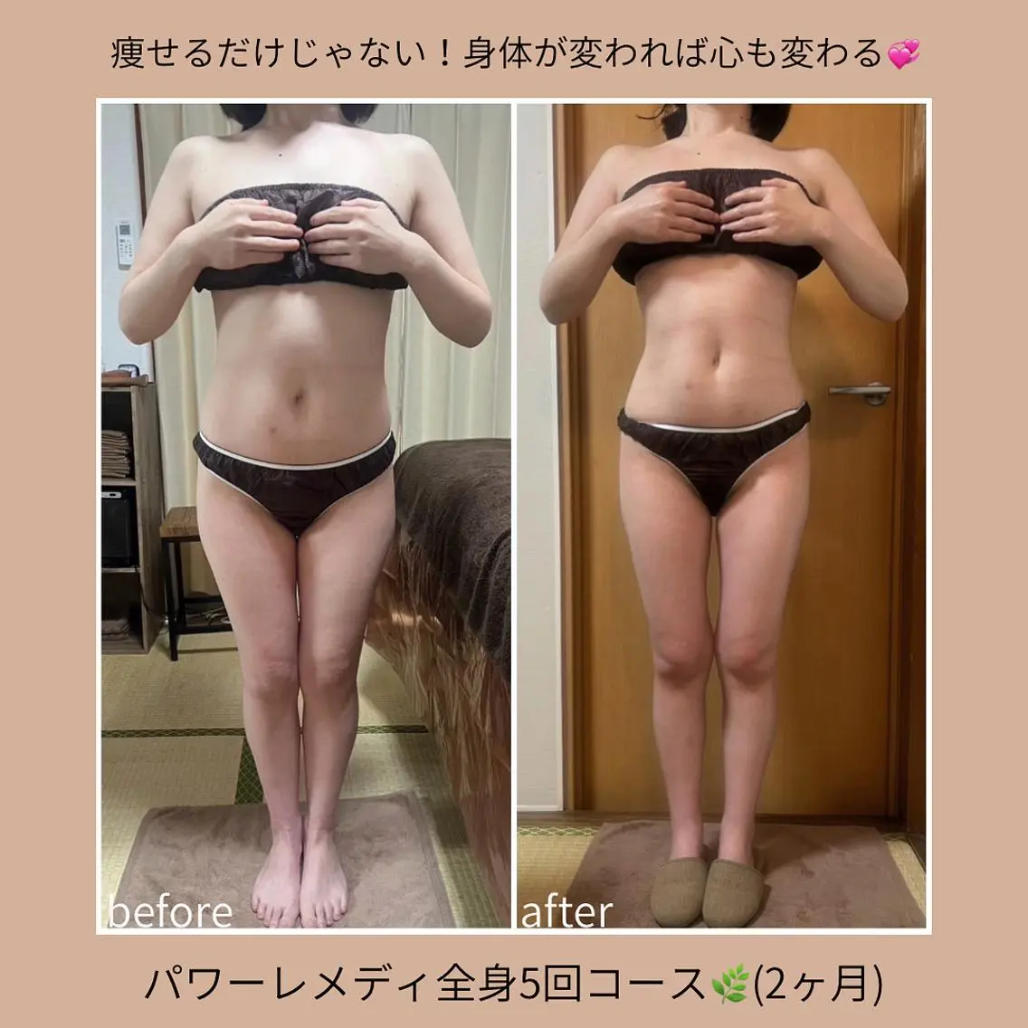 《本気痩せ×疲労改善 》 BILOOPのエステ・リラクイメージ