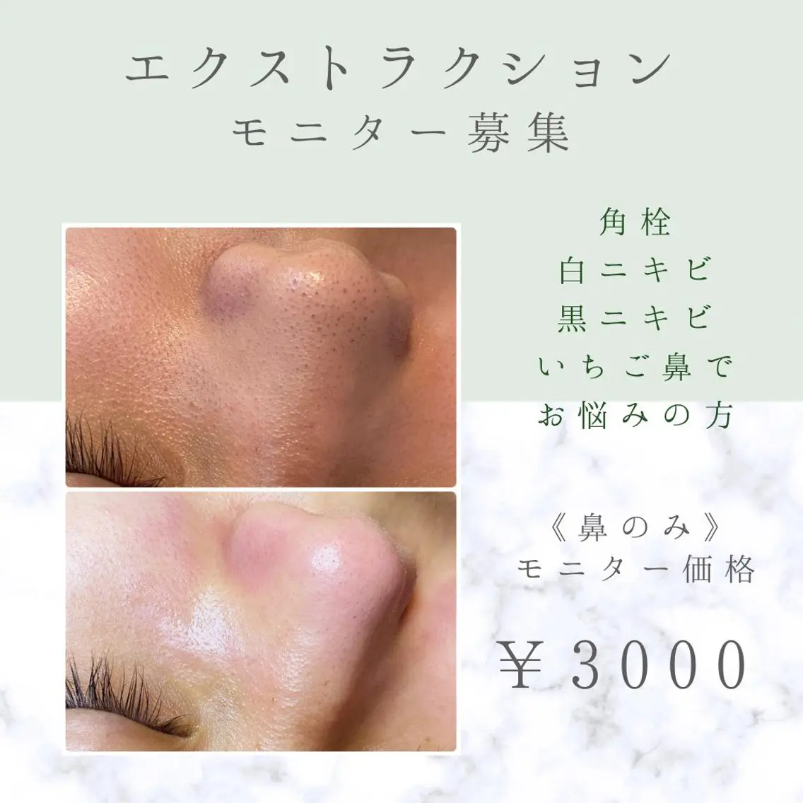 多摩境ViVi chinamiのエステ・リラクイメージ