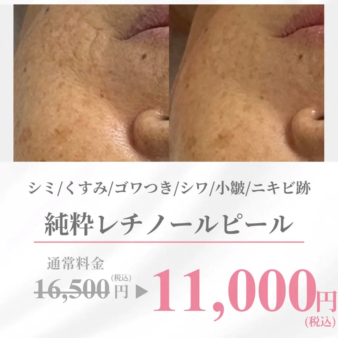 齋藤 祐里耶のエステ・リラクイメージ